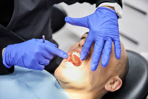 Best Emergency Wisdom Teeth Removal in South Monrovia Island, CA